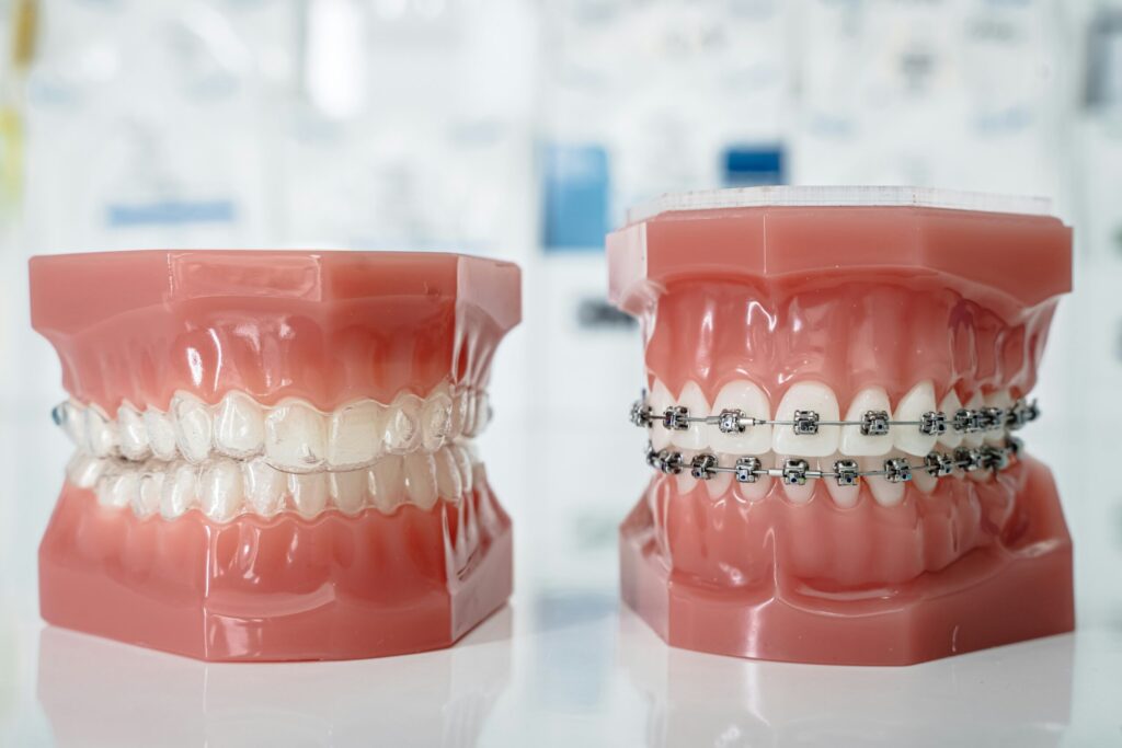 Commercial diligence on an orthodontic clinic consolidator